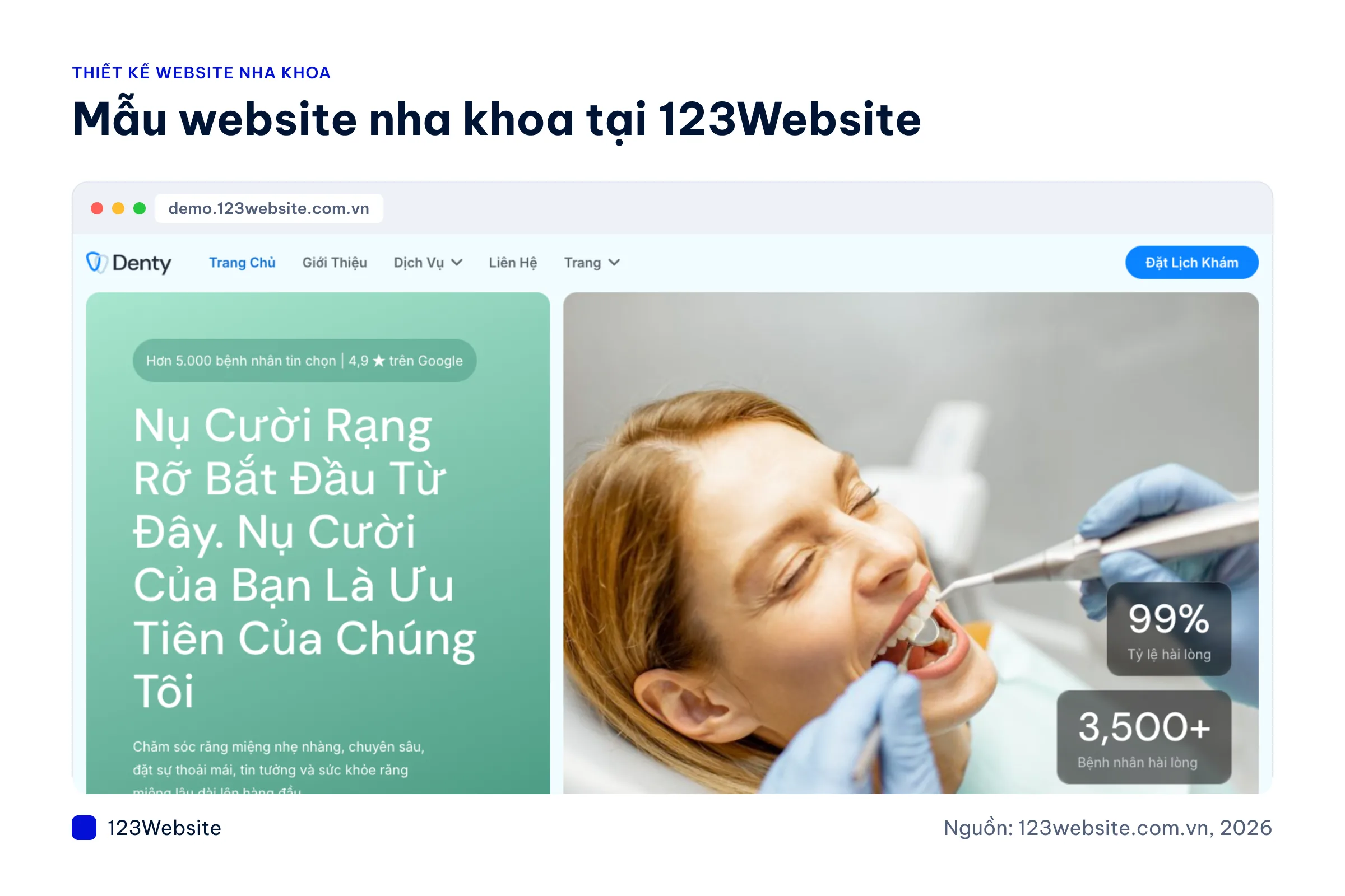 Ảnh chụp các mẫu website nha khoa Velioden, Dentista, Smilora, DENTEX, Denty, Shinental